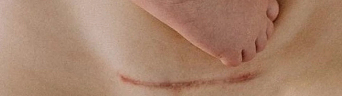 Accouchement vaginal après césarienne : qu’en disent les études ?