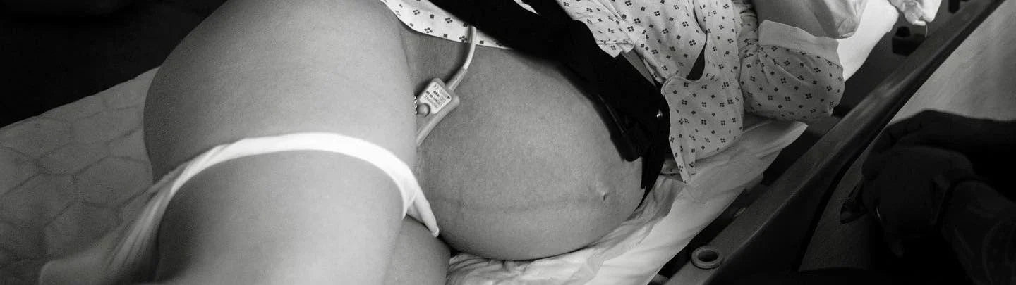 Déclenchement accouchement : pourquoi et comment ça se passe ?