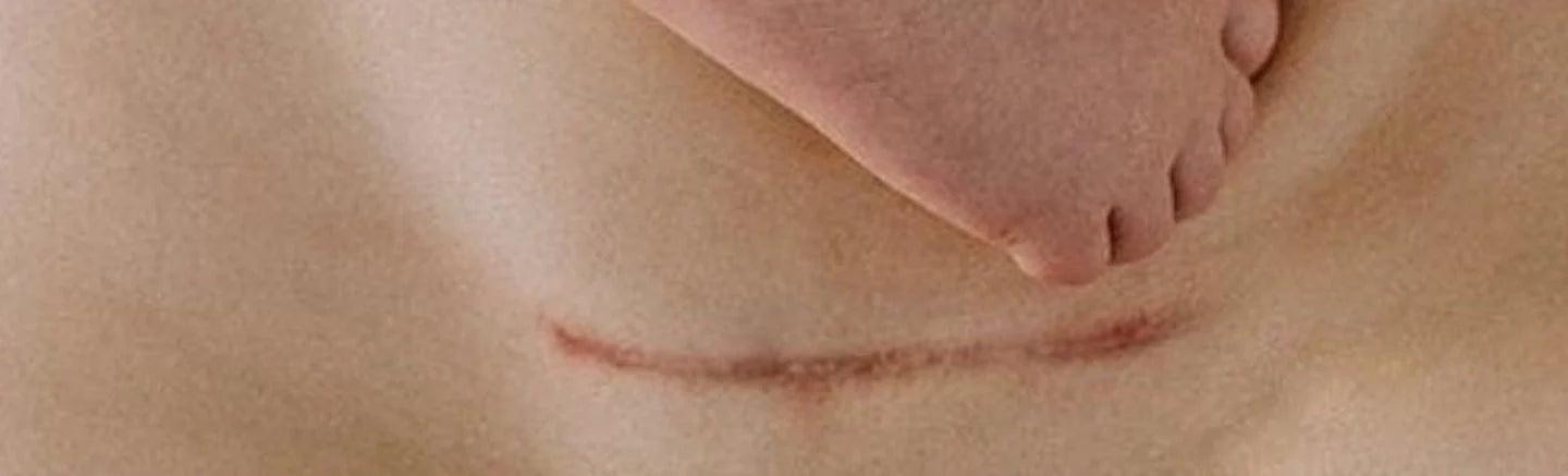 Doula, tout savoir sur l’accompagnement avant la naissance